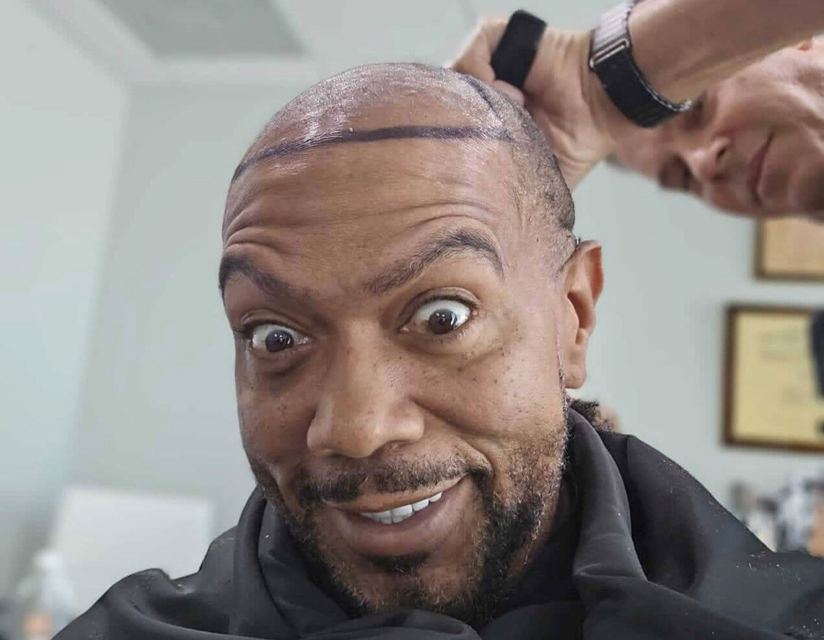 Read more about the article Timbaland Shows Off His New Hair After Transplant