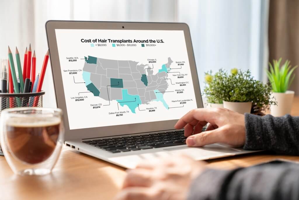 what goes into the cost of a hair transplant