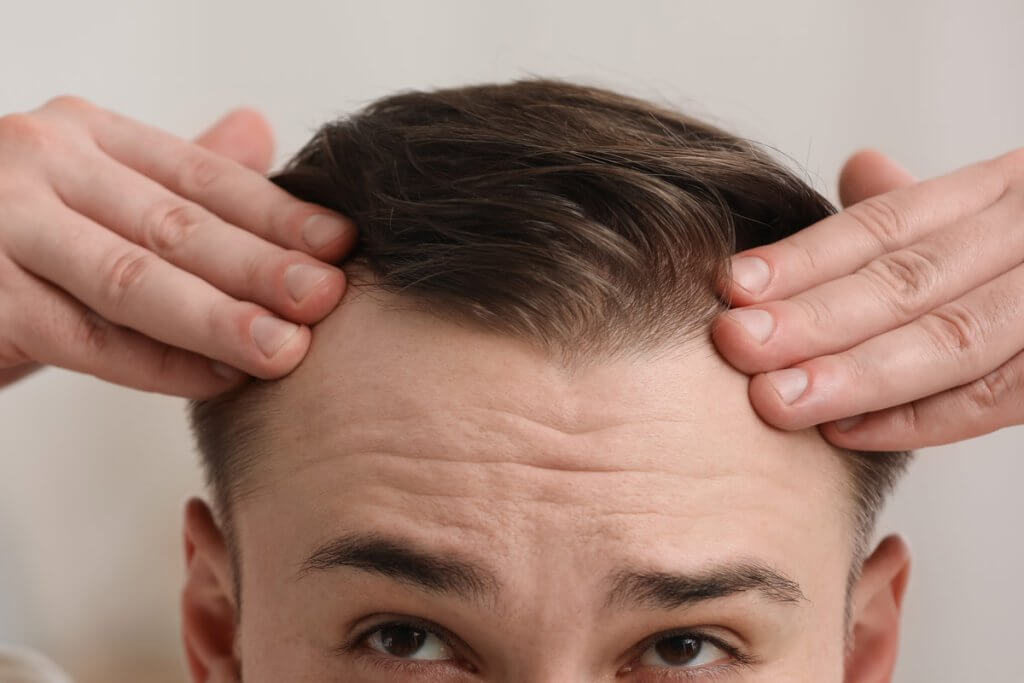 widows peak hair transplants